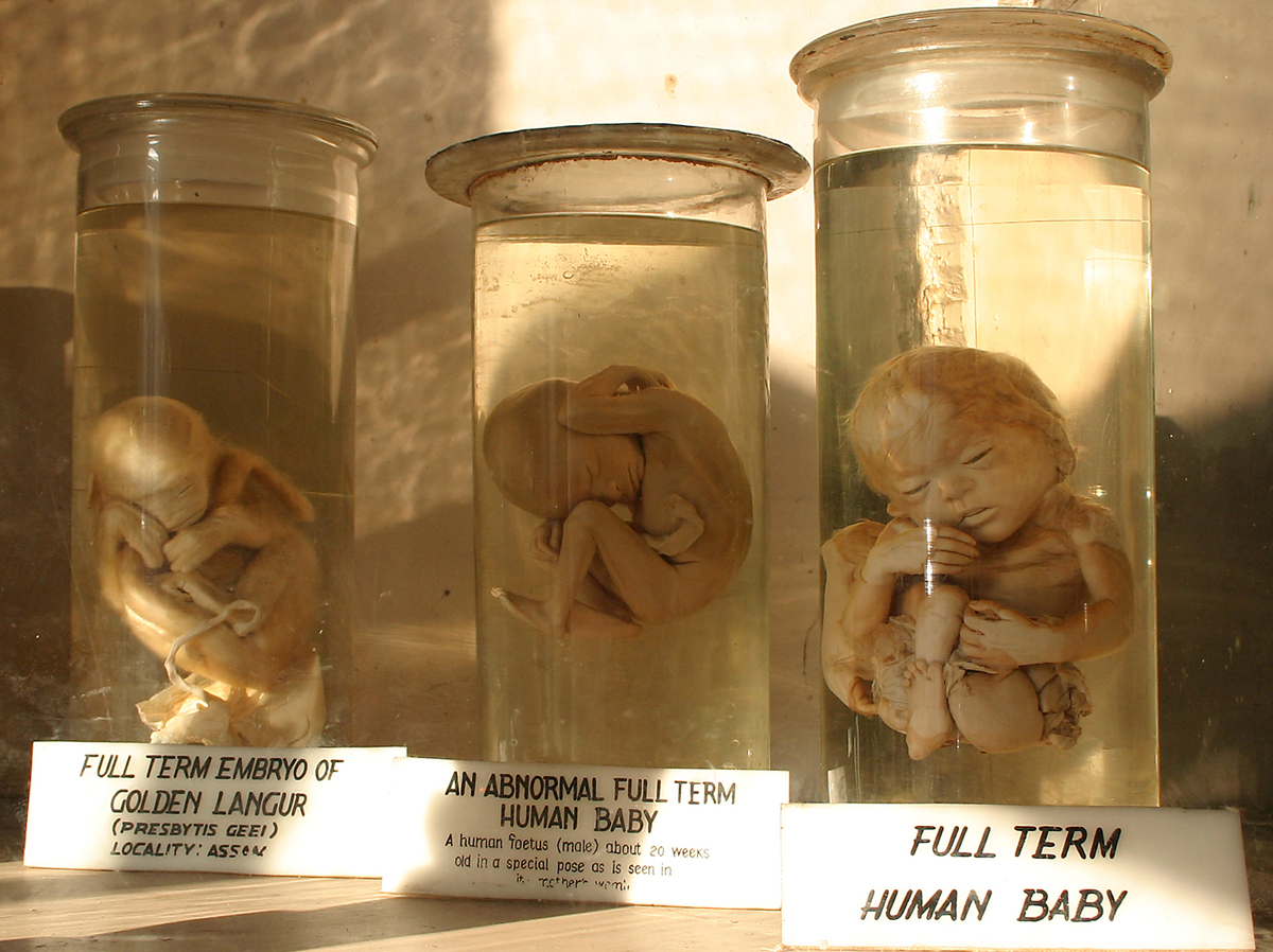 Embryos on display